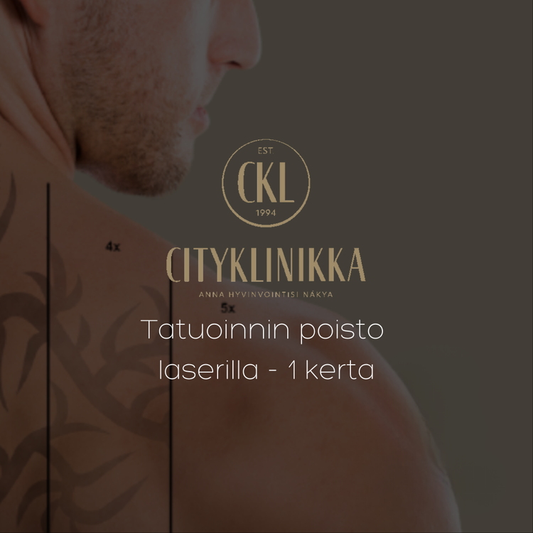Laser tattoo removal &mdash;  one time / Test treatment